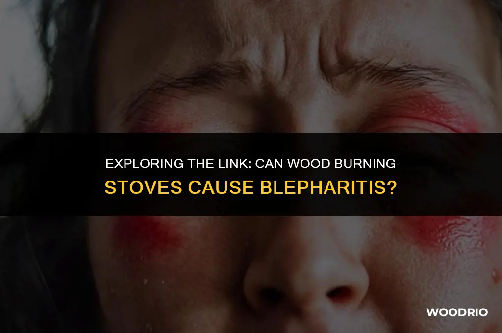 can blepharitis be caused by wood burning stoves