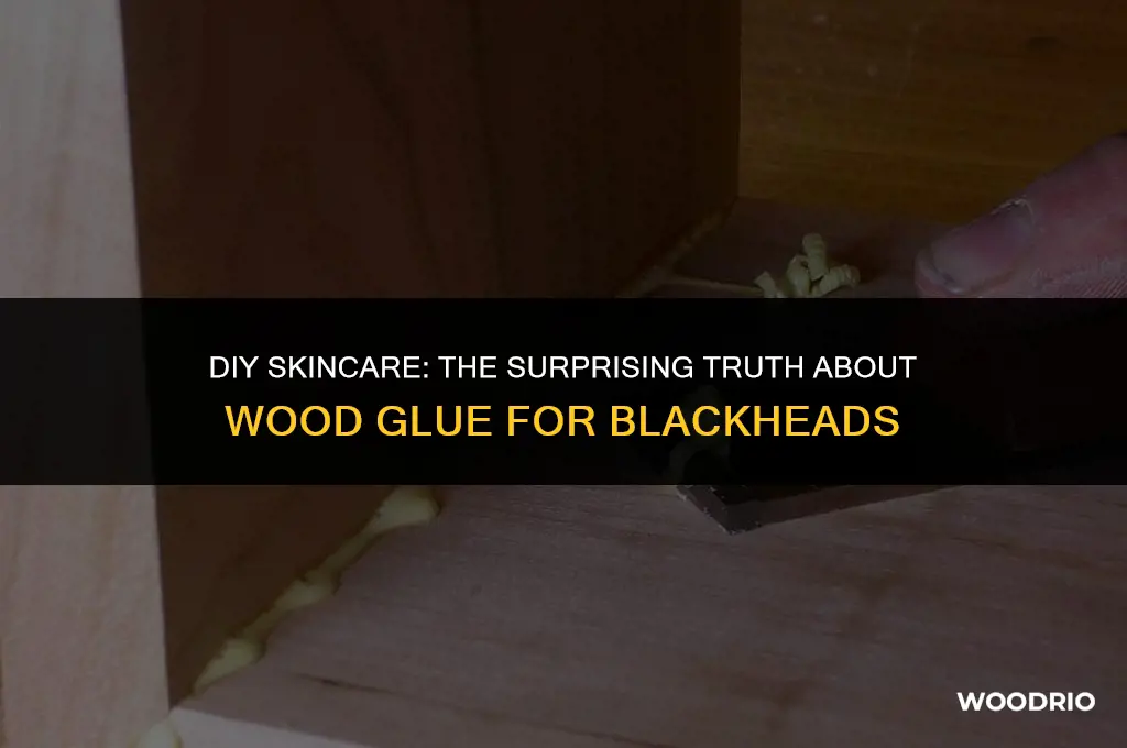 can wood glue remove blackheads