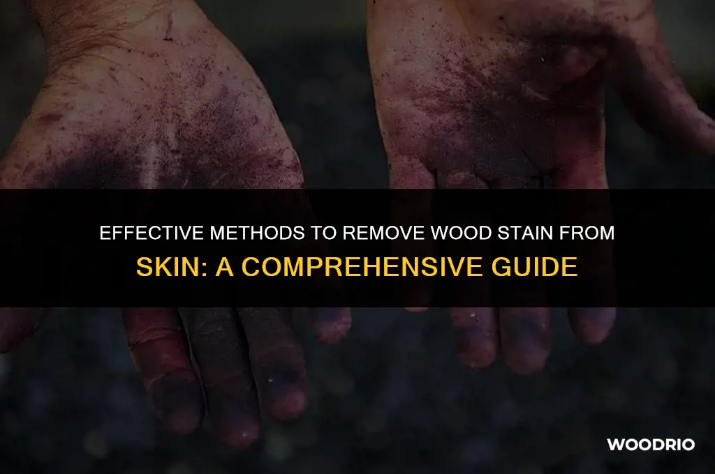 can you remove wood stain from skin