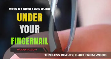 Splinter Survival Guide: Safely Removing Wood Splinters from Under Your Fingernail