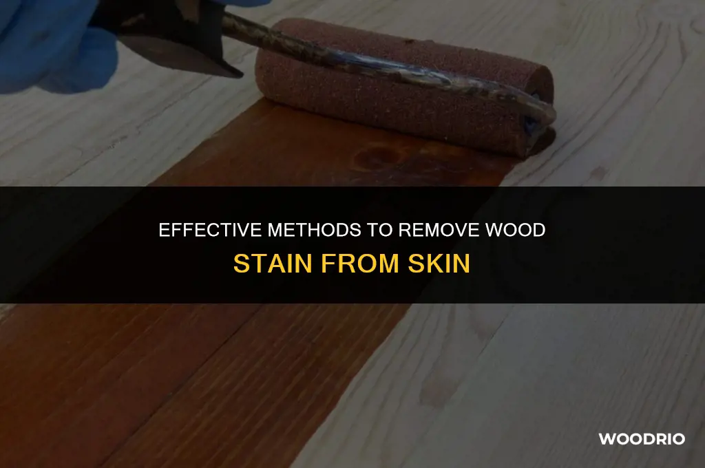 how do you remove wood stain from skin