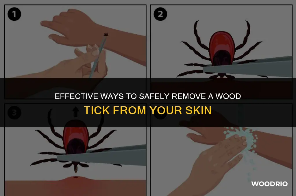 how to remove a wood tick