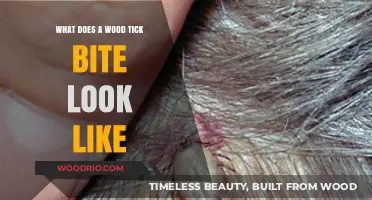 Identifying Wood Tick Bites: A Visual Guide and Symptoms Overview