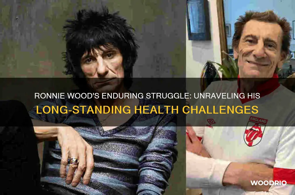 why has ronnie wood looked so bad for so long