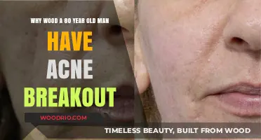 Elderly Acne: Understanding Unexpected Breakouts in Aging Skin